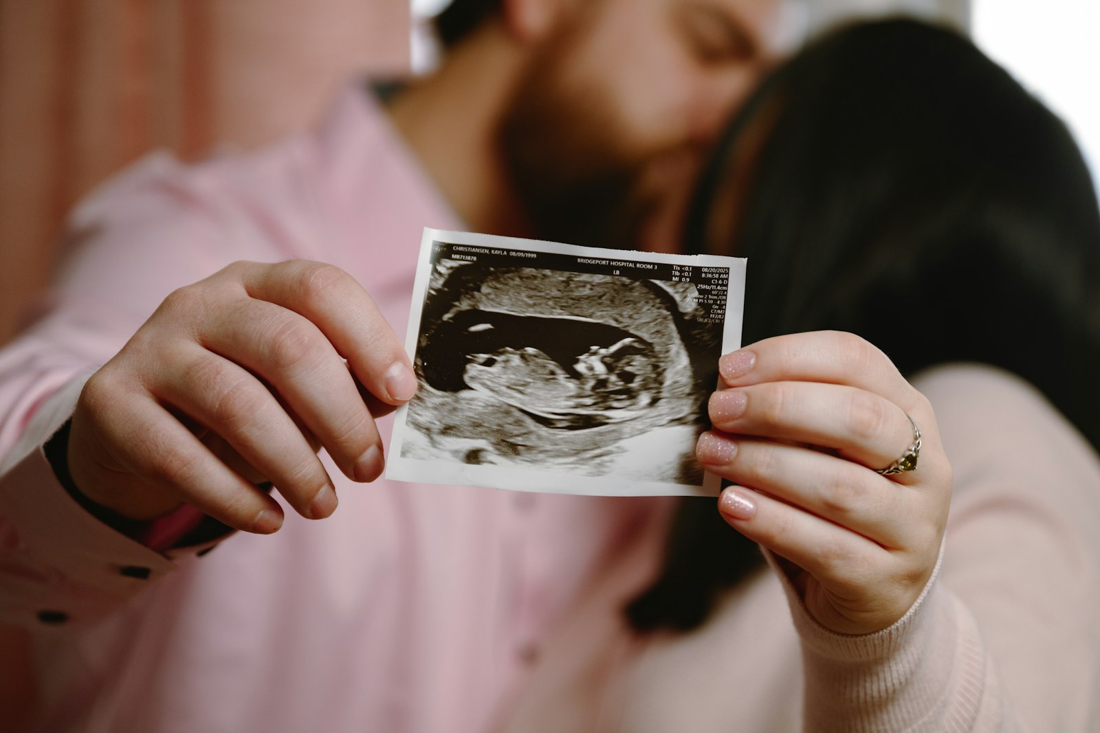 Paar hält ein Ultraschallbild ihres Babys